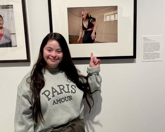 다운증후군이더라도 무엇이든 할 수 있다는 것을 보여줬다. 엘리 골든스타인 