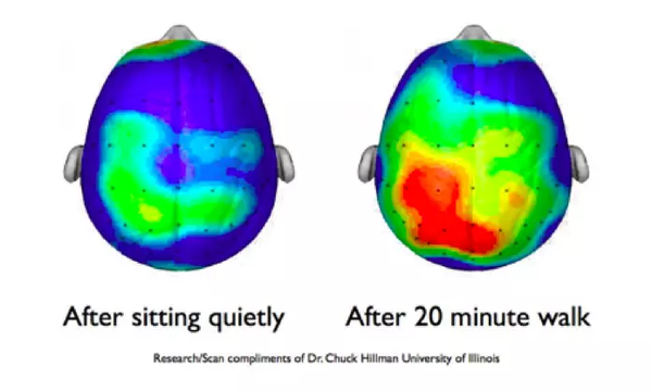 조용히 앉아있은 후 두뇌 활동, 20분간 걷기 후 두뇌 활동 일리노이대학 처크 힐먼 교수. SSHL 