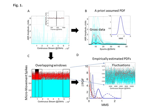 소리에 대한 뇌간 반응, 자폐아는 달랐다...조기진단 가능성 열어