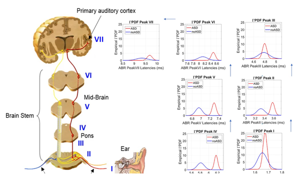 소리에 대한 뇌간 반응, 자폐아는 달랐다...조기진단 가능성 열어