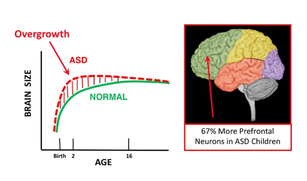 자폐스펙트럼장애의 초기 뇌 과성장을 보여주는 그림.  자폐 남아는 대조군에 비해 전전두엽 뉴런이 평균 67% 더 많은 것으로 나타났다. 분자정신의학지 