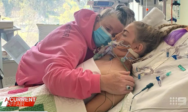 호주에서는 13세 소녀 에스라 헤인즈가 크로밍을 하다 심정지로 사망했다. 커런트어페어 