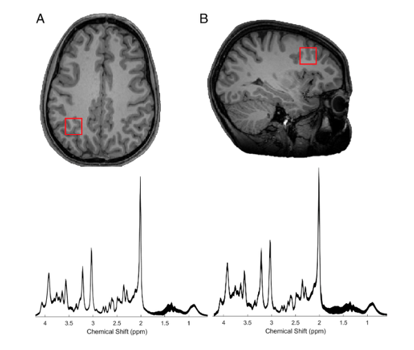 [분석-에듀리서치] 수학 일찍 포기할수록 기억력‧인지기능 발달 안돼