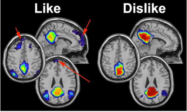 음악의 영향은 청각 피질을 넘어 감정, 논리, 기억 네트워크에까지 영향을 미친다. 따라서 음악 감상과 학습은 기분 변화와 감정 조절에 영향을 미치는 전체 두뇌 운동과 유사하다. 리서치게이트 